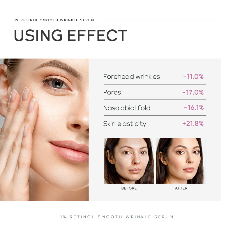 Quiyum %1 Retinol Pürüzsüzleşt - The Ordinary Serum Hyaluronic Acid incelemesi ve fiyatı