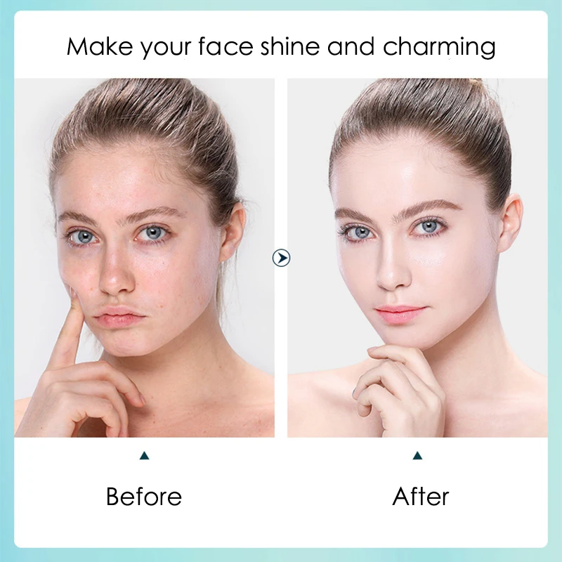 10 adet Hyaluronik Asit Nemlen - Sheet Face Mask Pack incelemesi ve fiyatı